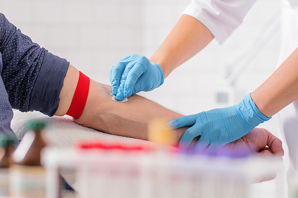 Hepatits vorsage